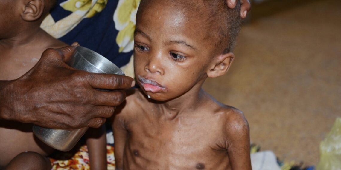 Somalie : la faim revient, entre sécheresse, conflits et recul de l’aide humanitaire